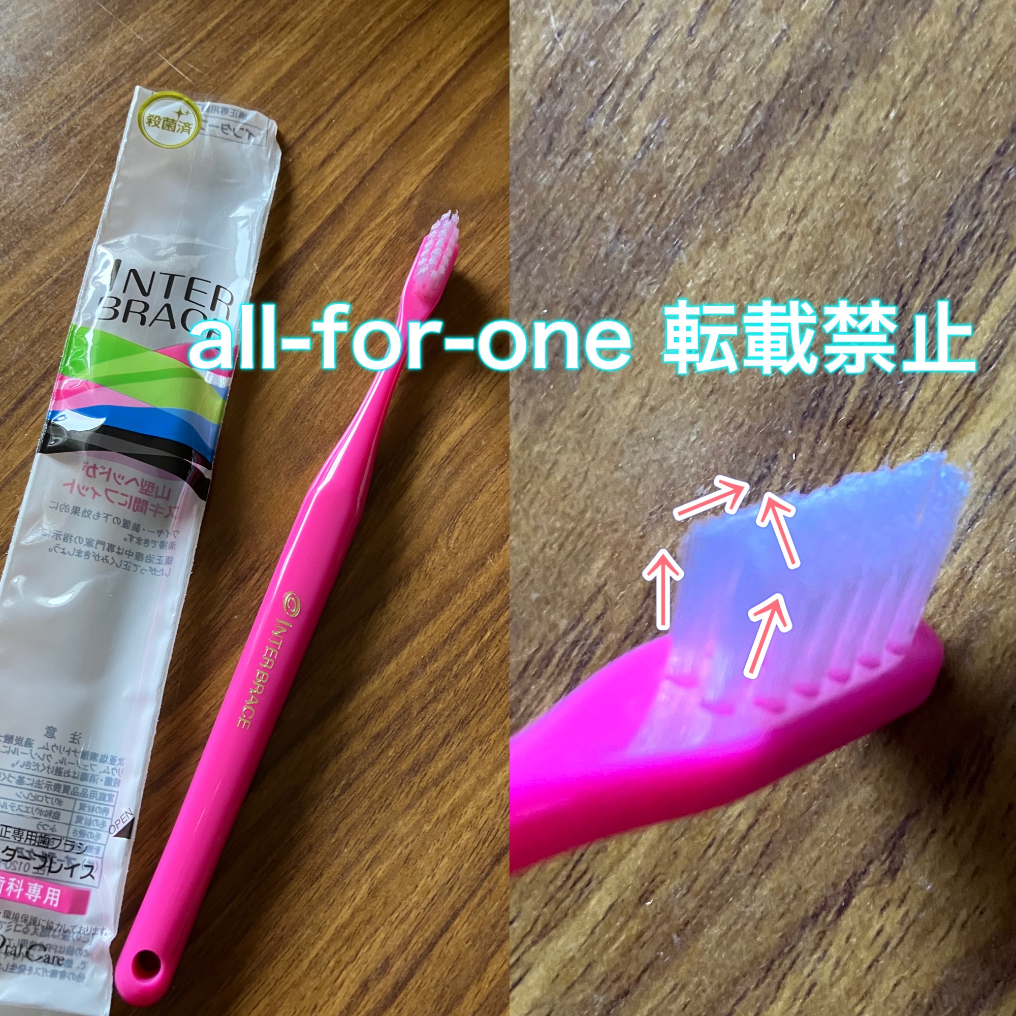 歯列矯正中のおすすめ歯ブラシ「インターブレイス」